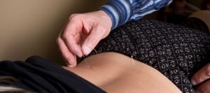 Anxiety and Depression Relief with Acupuncture in Springfield MO
