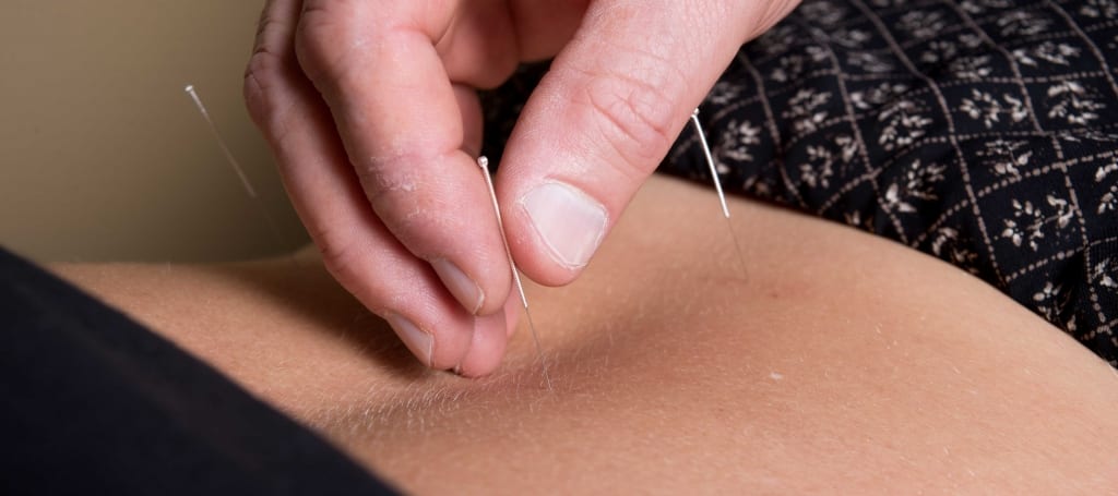 Best Chiropractor for Traditional Accupuncture in Springfield MO