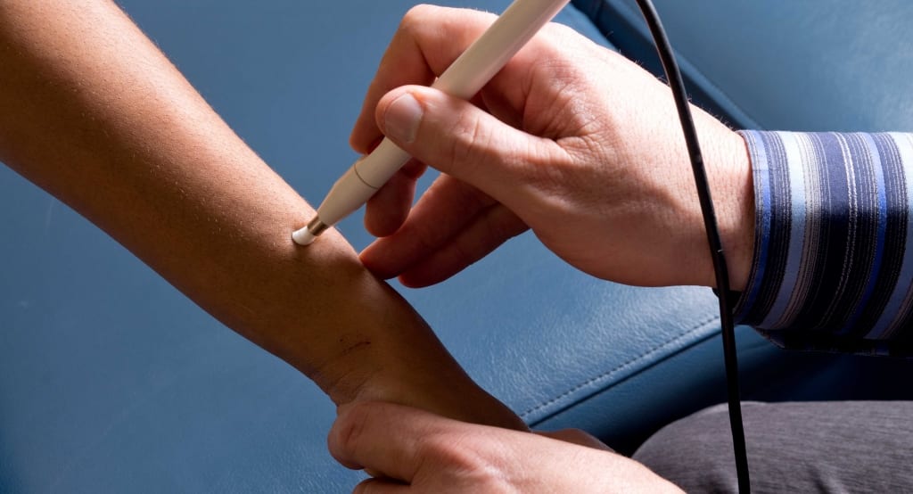 Electroacupuncture using Microcurrent - Wrist Pain in Springfield MO